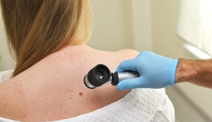 A,Dermatologist,Oncologist,Uses,A,Dermatoscope,To,Examine,Moles,And